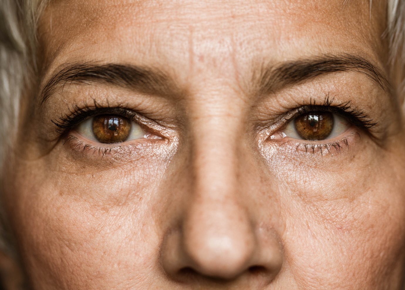 J'ai l'air fatigué | Causes et traitements | Centre médecine esthétique G&S | Toulouse