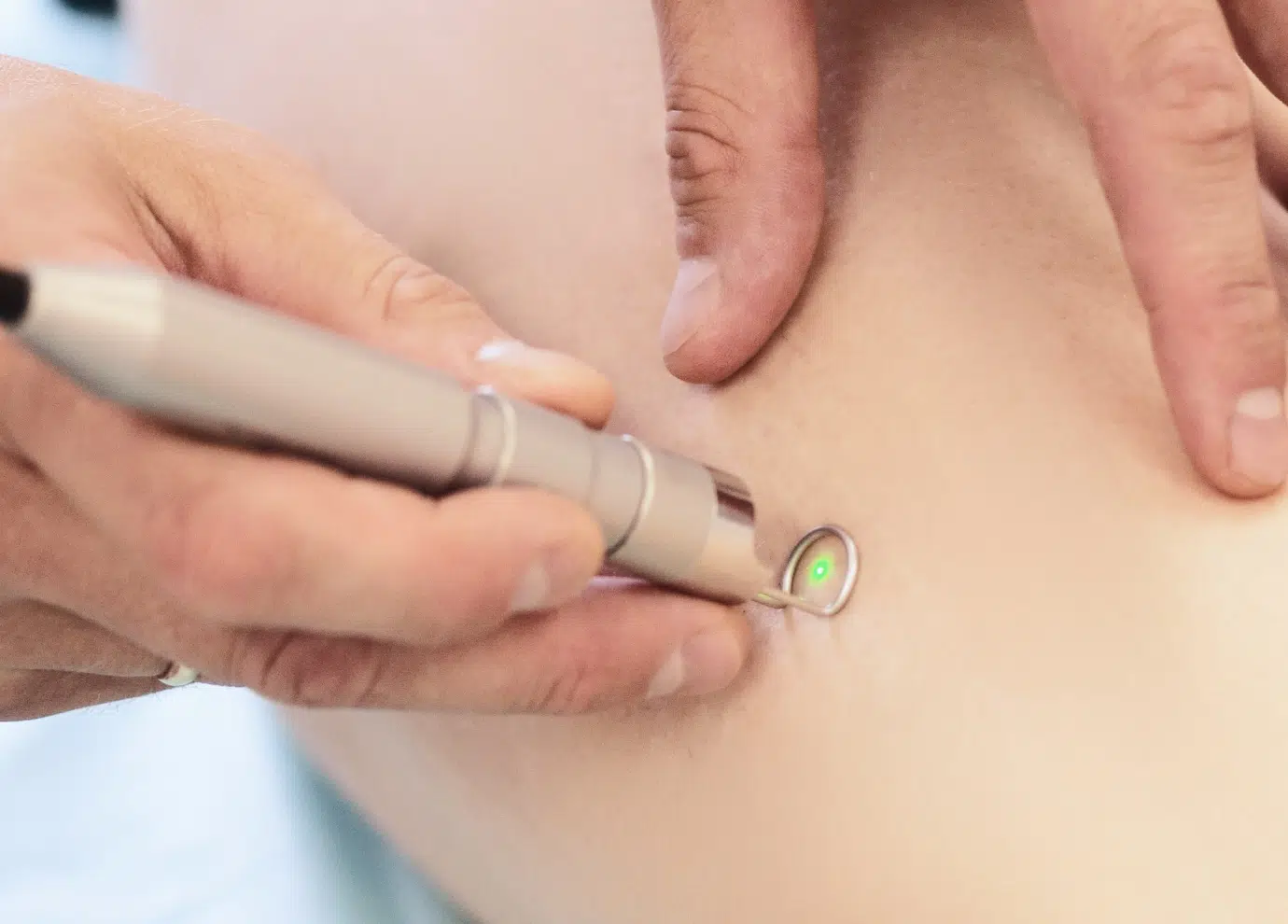 Laser vasculaire à Toulouse | Traitement des varices | Centre médecine esthétique G&S