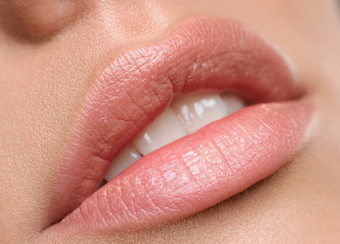 Acide hyaluronique lèvres à Toulouse | Tarifs | Centre médecine esthétique G&S