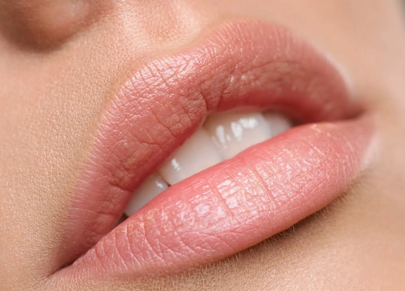 Acide hyaluronique lèvres à Toulouse | Tarifs | Centre médecine esthétique G&S