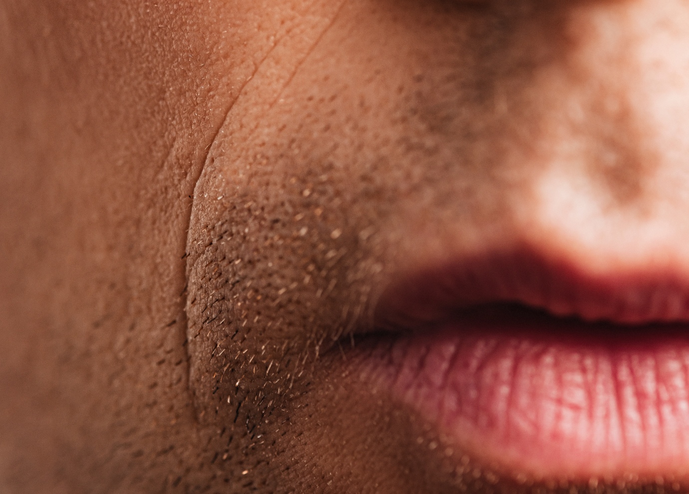 Acide hyaluronique sillons nasogéniens à Toulouse | Centre médecine esthétique G&S