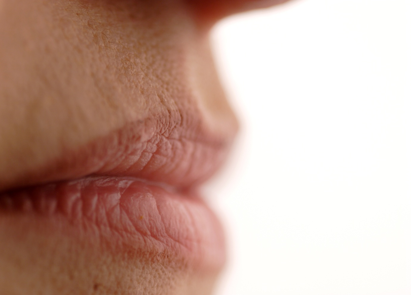 Acide hyaluronique zones péribucale à Toulouse | Centre médecine esthétique G&S